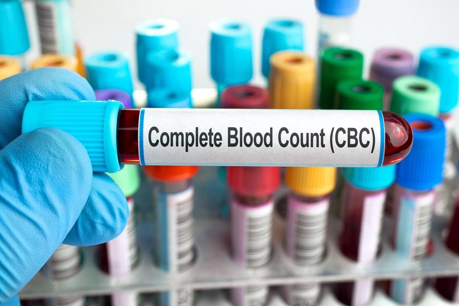 Does A Full Blood Count Show Cancer