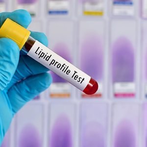 Lipid Profile
