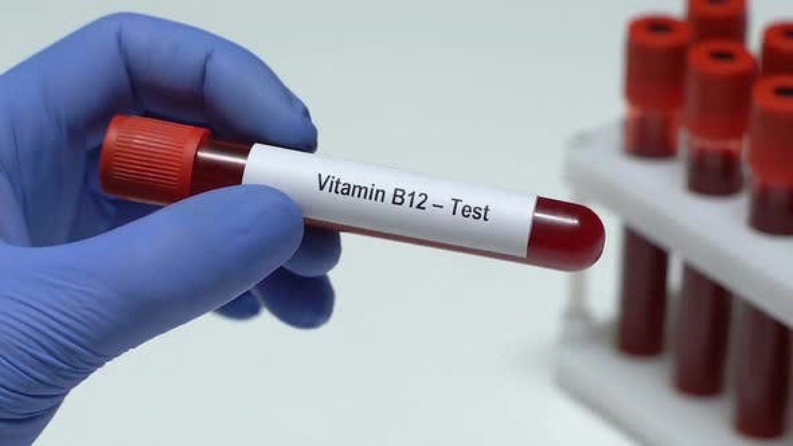 vitamin-b-12-test-medkare