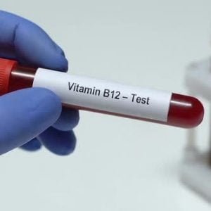 Vitamin B-12 Test