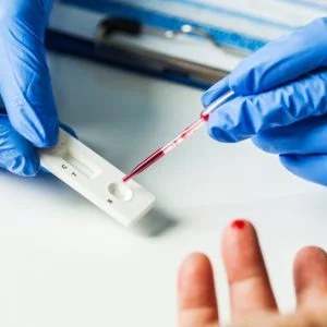 Basic Covid 19 Antibody Test