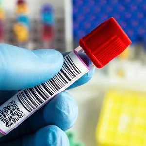 Complete Covid 19 Antibody Test